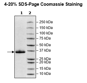 Spike S1 RBD, Avi-His-tag (SARS-CoV-2) Recombinant