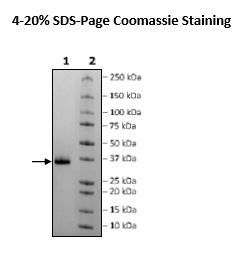 Spike RBD (B.1.1.7, Alpha Variant), Avi-His-Tag (SARS-CoV-2) Recombinant