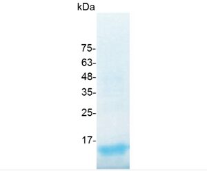 TGF beta 1 (Transforming growth factor β1), Human