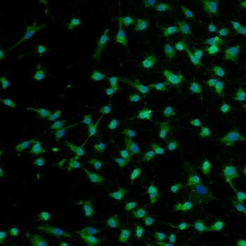 FC-0024-Adult-Fibroblasts-20x-anti-CD29-DAPI-350x350