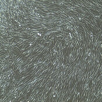FC-0024_Adult-Fibroblasts_10x-350x350